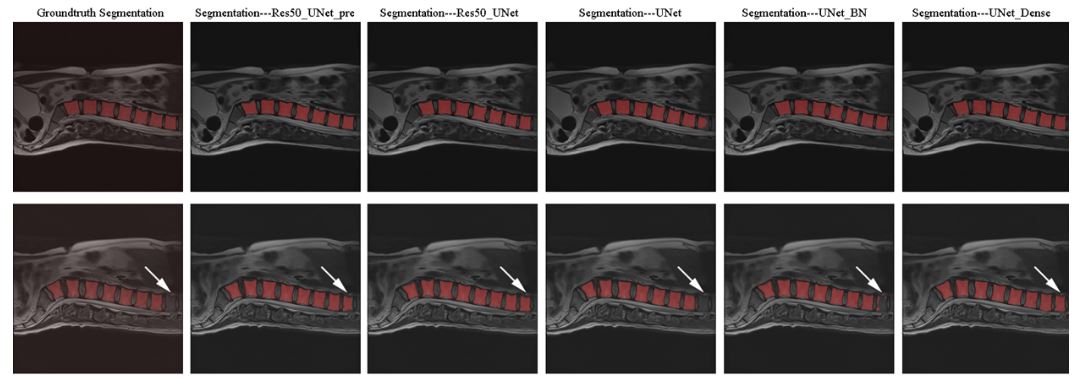 Graphics showing medical image segmentation